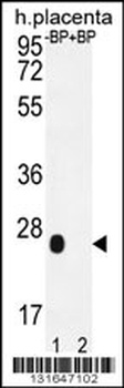OR2J3 Antibody