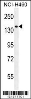 PLCL2 Antibody