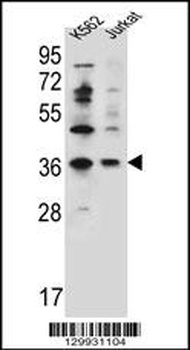 PPP1R3G Antibody
