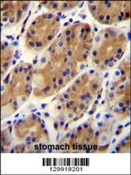 CCDC153 Antibody