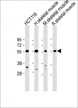 TRIM72 Antibody