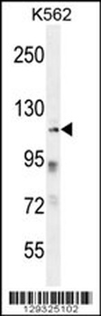 ZNF99 Antibody