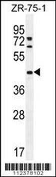METTL2A Antibody