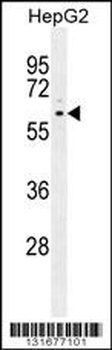 PPARD Antibody
