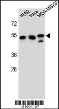 TUBB6 Antibody