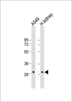 PABPN1L Antibody