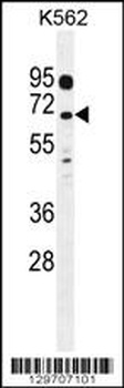 LRRC63 Antibody
