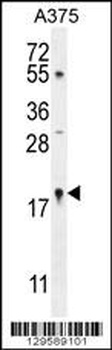 SNRNP27 Antibody