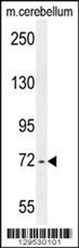 ZBTB24 Antibody