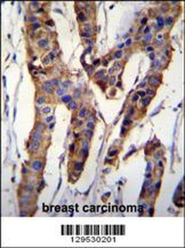 ZBTB24 Antibody