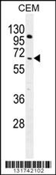 COL8A2 Antibody