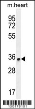 ZNF524 Antibody
