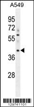 MYBPHL Antibody