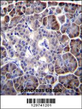 MYBPHL Antibody
