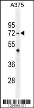 TRIM56 Antibody