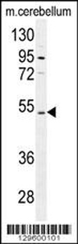 CNGA4 Antibody