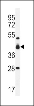 VSIG8 Antibody