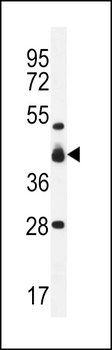VSIG8 Antibody