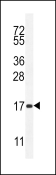 SPACA5 Antibody