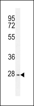 PTPN20A Antibody