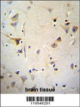 AGBL5 Antibody