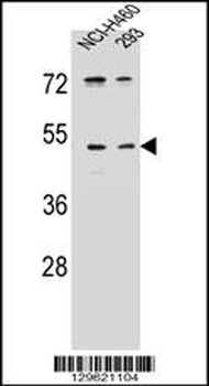 PRSS55 Antibody