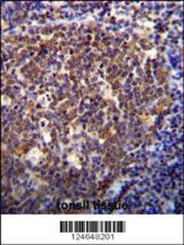 HOXB6 Antibody