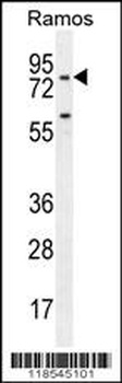 PDE4B Antibody