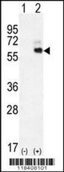 KNG1 Antibody