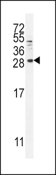 BTC Antibody