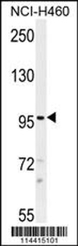 TRPM8 Antibody