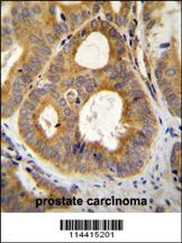 TRPM8 Antibody
