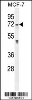 GALNS Antibody