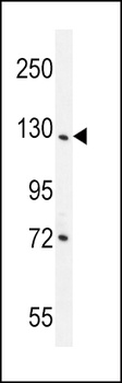 DDX60L Antibody