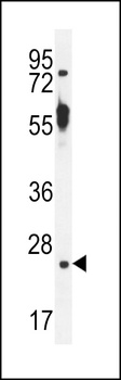 TTC9B Antibody