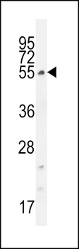 CCDC61 Antibody