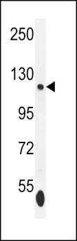 SMARCA5 Antibody