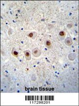 RBM14 Antibody