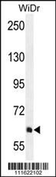 PIK3R5 Antibody