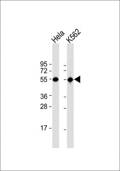 ATP6V1B1 Antibody