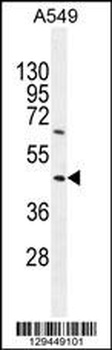 TRIM43 Antibody