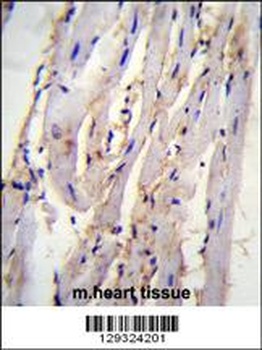 STX19 Antibody