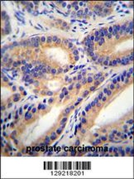 HSD11B1L Antibody