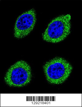 HSD11B1L Antibody