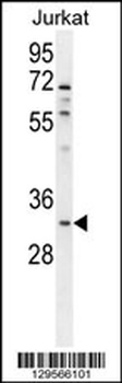 OR5B12 Antibody