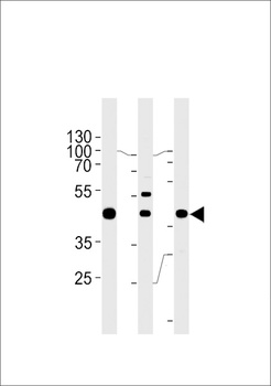 GTF2H2C Antibody