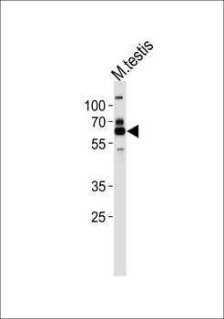 ZSCAN5B Antibody