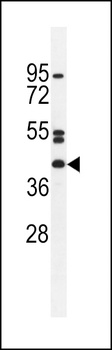 NT5DC4 Antibody