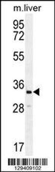 CLVS2 Antibody