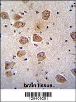 CLVS2 Antibody